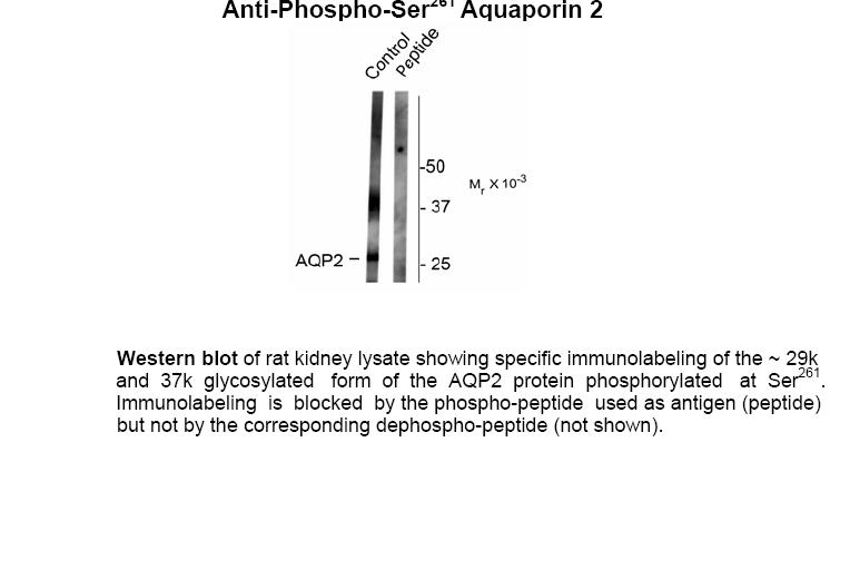Aquaporin 2 (phospho Ser261) Antibody