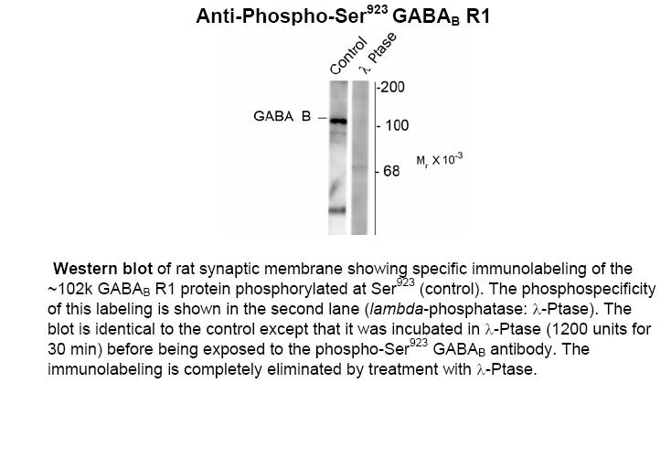 GABAB Receptor (phospho Ser923) Antibody