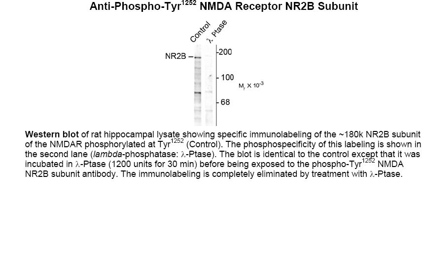 NMDA (phospho Tyr1252) Antibody