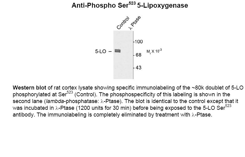 5 Lipoxygenase (phospho Ser523) Antibody
