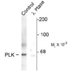 Western blot of rat synaptic membrane showing specific immunolabeling of the ~66 k PLK1protein phosphorylated at Thr210 (control). The phosphospecificity of this labeling is shown in the second lane (lambda-phosphatase: lambda-Ptase). The blot is identical to the control except that it was incubated in lambda-Ptase (1200 units for 30 min) before being exposed to the phospho-Thr210 PLK1 antibody. The immunolabeling is completely eliminated by treatment with lambda-Ptase.