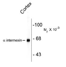 Alpha Internexin Antibody [1D2]