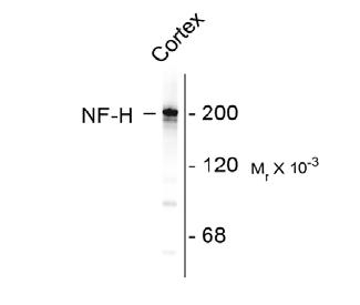 Neurofilament NF-H Antibody [NAP4]