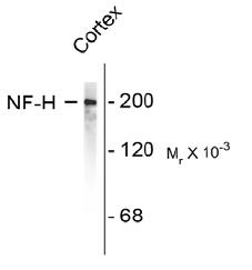 Neurofilament NF-H Antibody