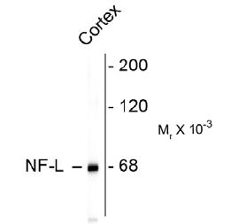 Neurofilament NF-L Antibody [DA2]
