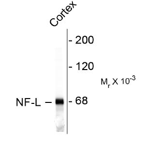 Neurofilament NF-L Antibody