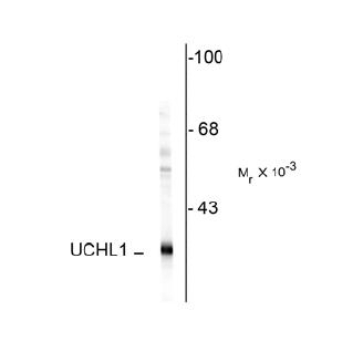 Peripherin Antibody [7C5]