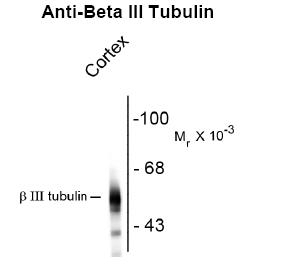 Beta III Tubulin Antibody [AA10]