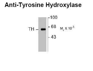 Tyrosine Hydroxylase Antibody