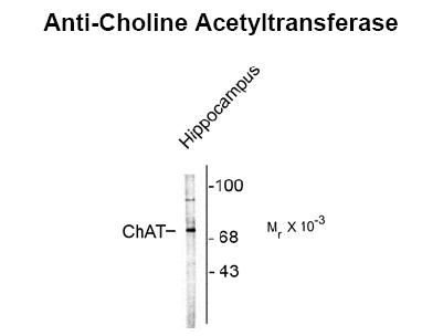 Choline Acetyltransferase Antibody