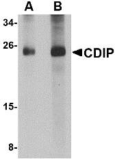 CDIP Antibody