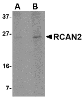 RCAN2 Antibody