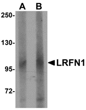 LRFN1 Antibody