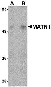 MATN1 Antibody
