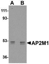 AP2M1 Antibody