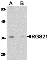 RGS21 Antibody