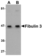 Fibulin 3 Antibody