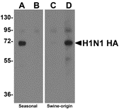Seasonal H1N1 Hemagglutinin Peptide