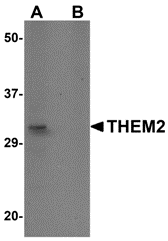 THEM2 Antibody