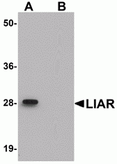LIAR Antibody