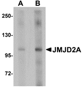 JMJD2A Antibody