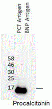 Procalcitonin Antibody [A12]