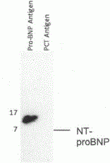 NT-proBNP Antibody [A10]