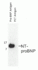NT-proBNP Antibody [F10]