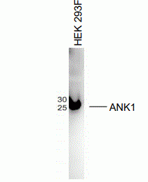 ANK1 Antibody [D4]