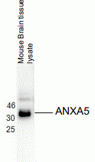 ANXA5 Antibody [B11]