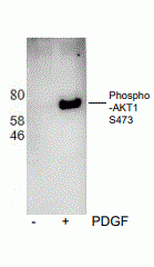 AKT1 (phospho S473) Antibody [H4]