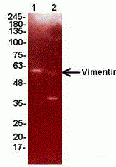 Vimentin Antibody [A1]