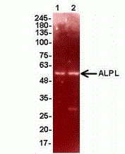 ALPL Antibody [H1]