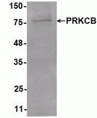 Protein Kinase C beta Antibody [G2]