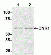 Cannabinoid Receptor 1 Antibody [E5]