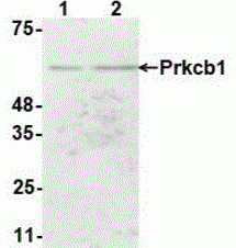 Protein Kinase C beta Antibody [D4]