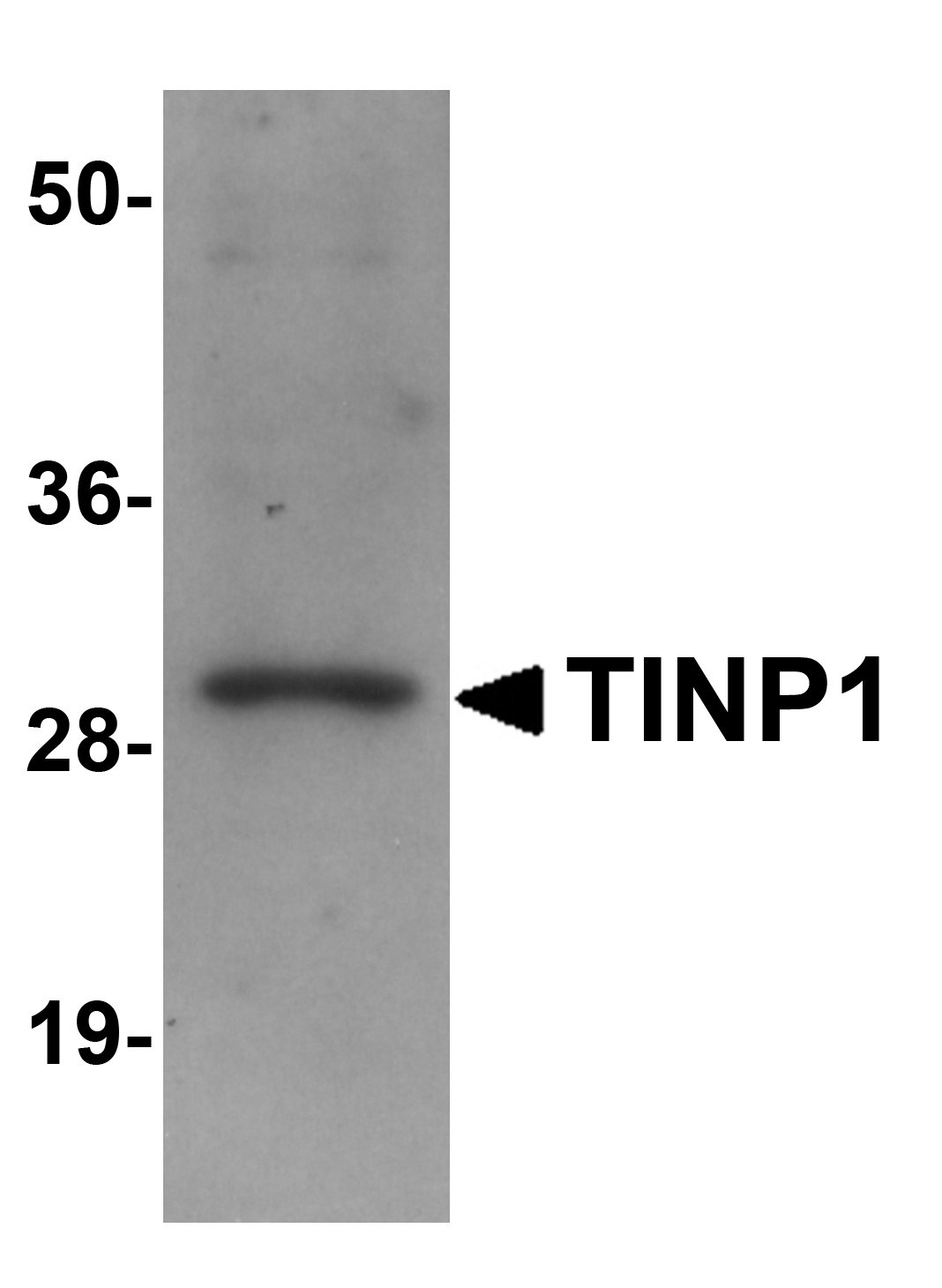 TINP1 Antibody