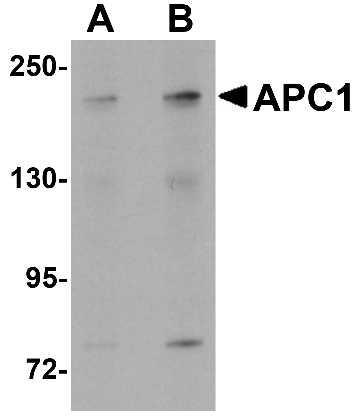 APC1 Antibody