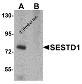 SESTD1 Peptide