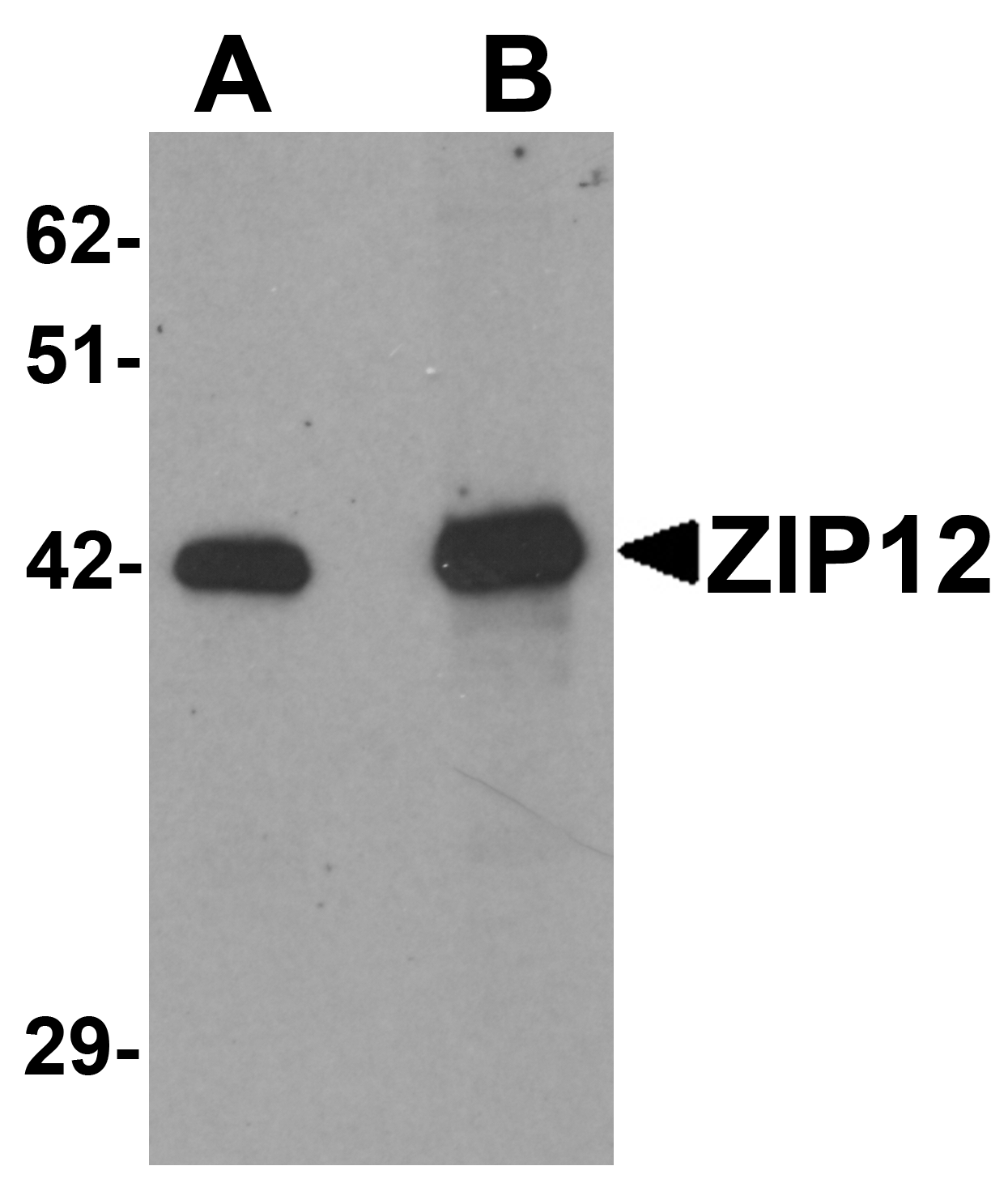 ZIP12 Antibody