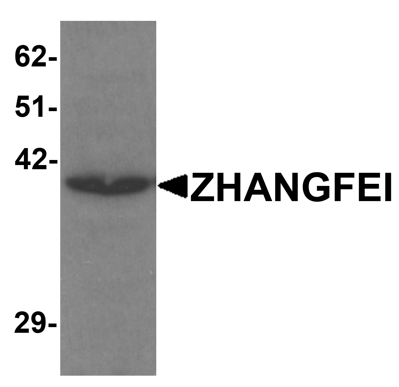 ZHANGFEI Antibody