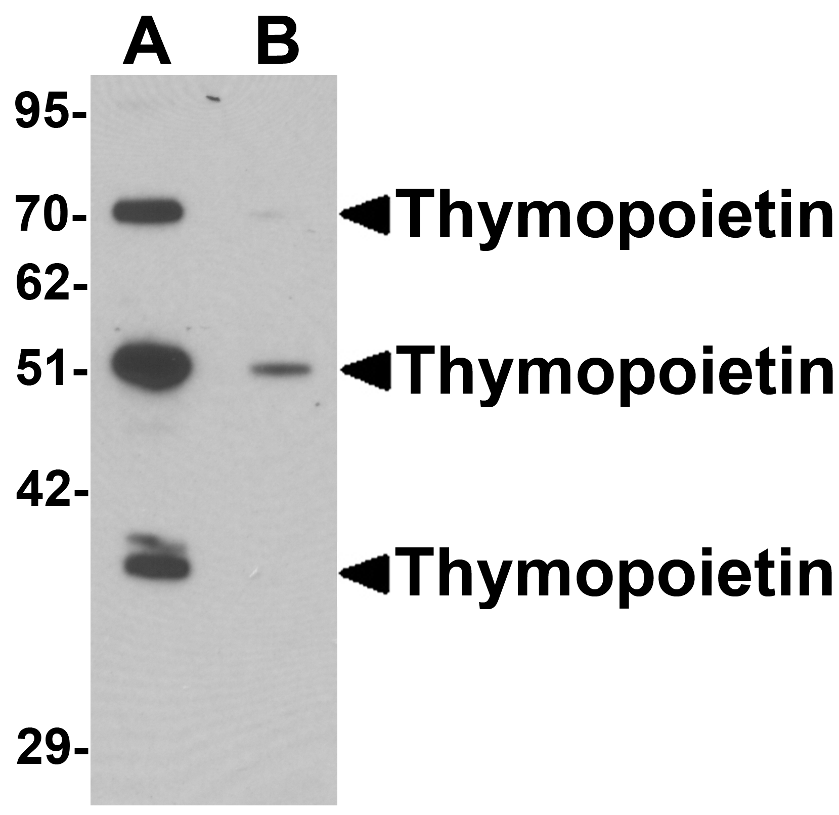 Thymopoietin Antibody