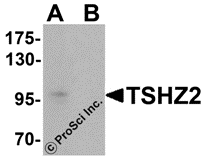 TSHZ2 Peptide