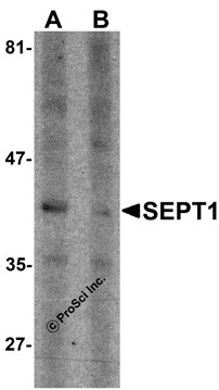 SEPT1 Peptide