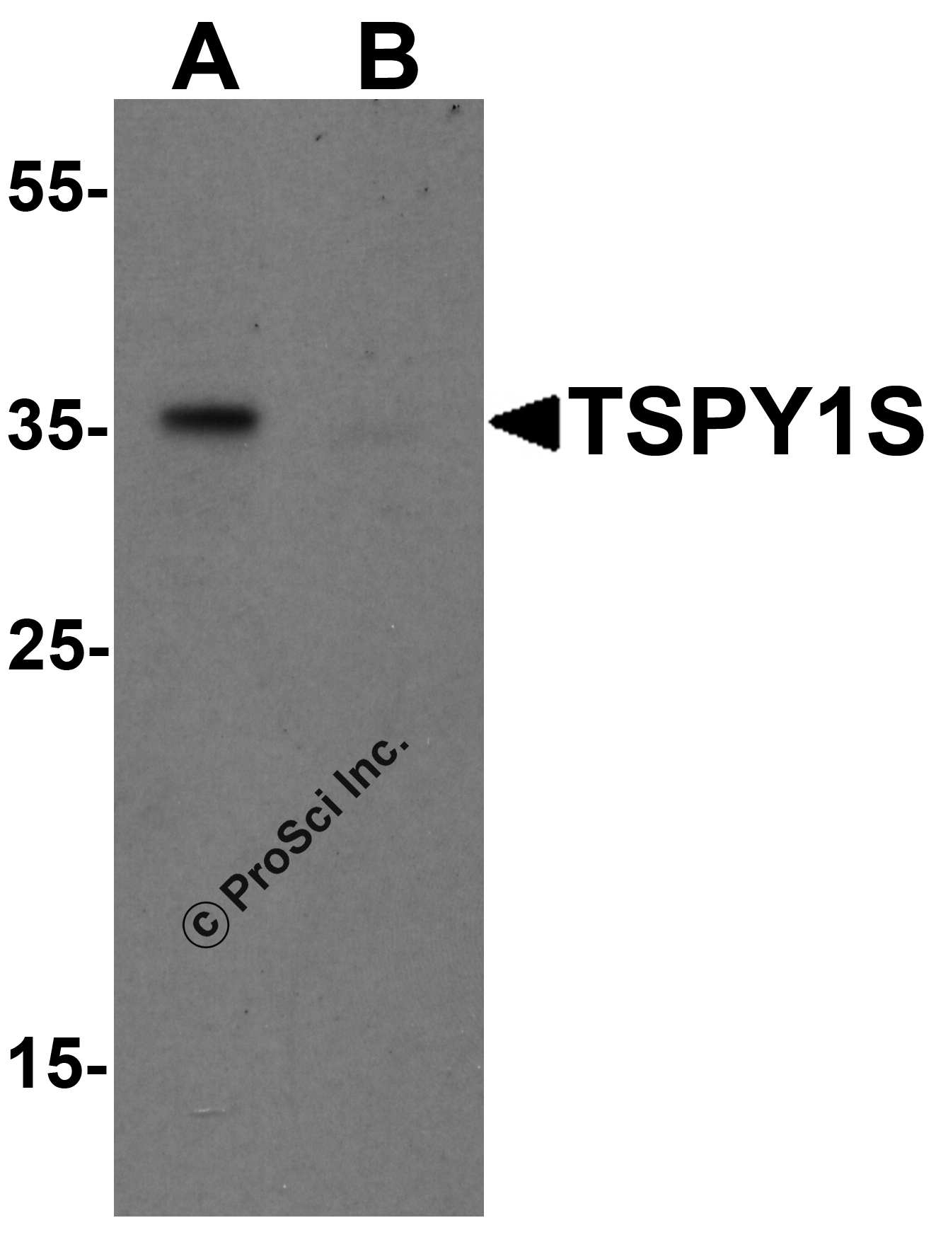 TSPY1S Peptide