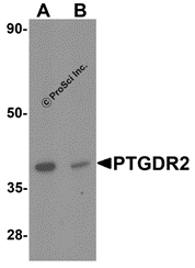PTGDR2 Peptide