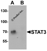 STAT3 Peptide
