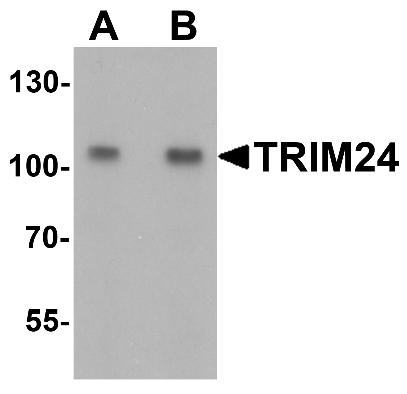 TRIM24 Antibody