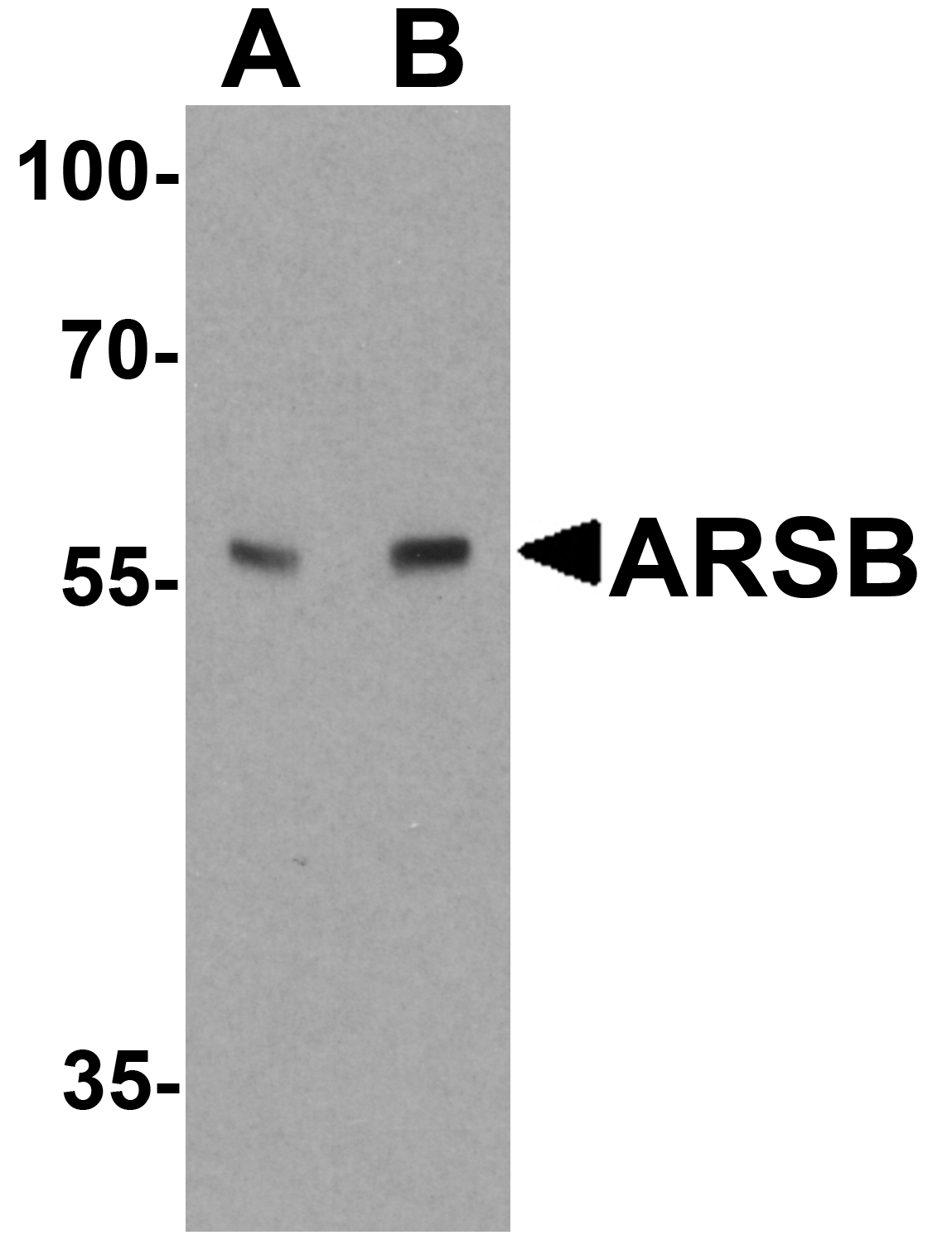 ARSB Antibody