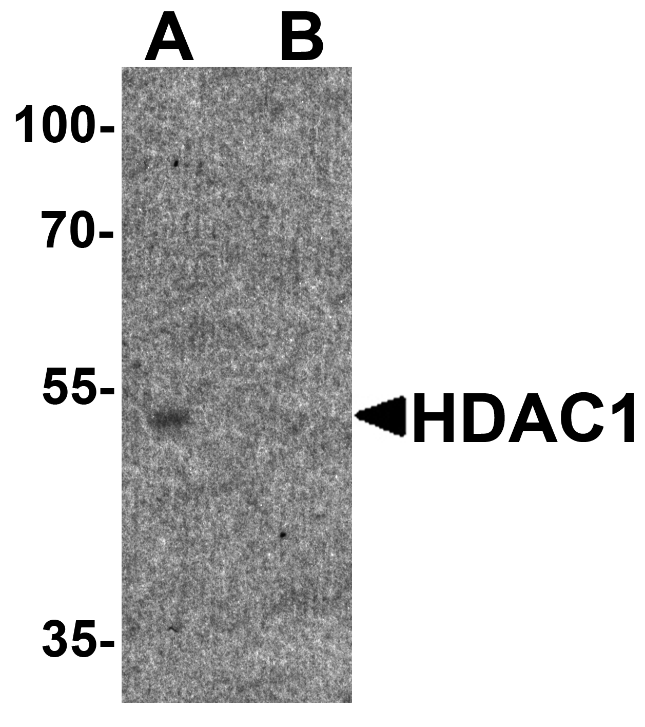 HDAC1 Antibody